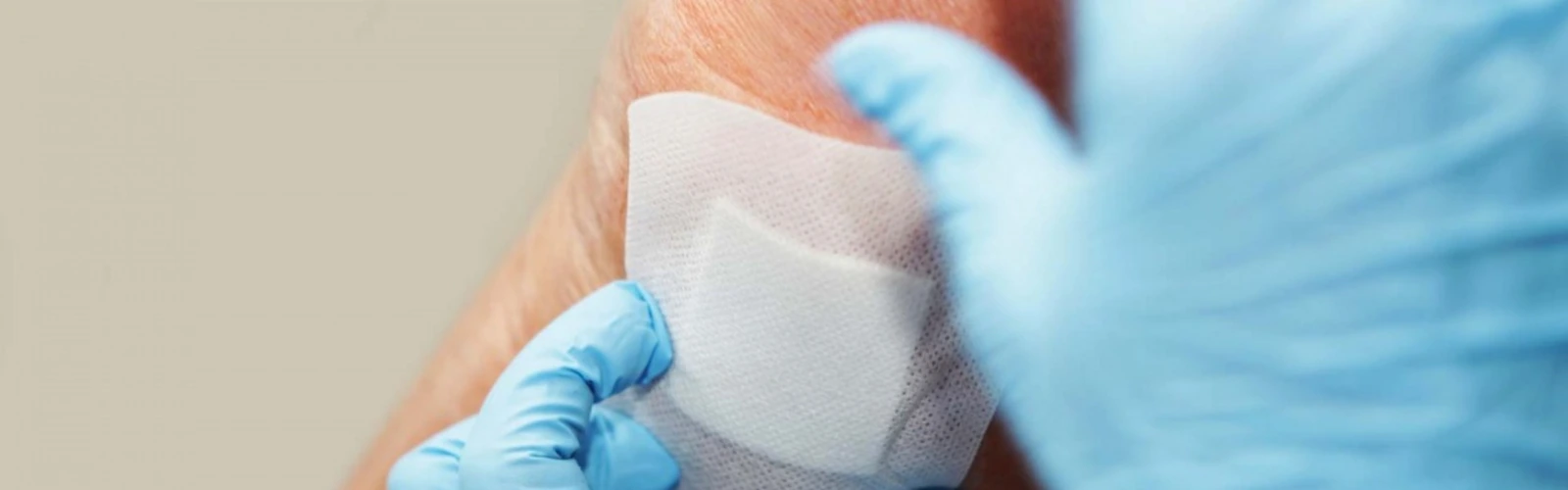 Discovery for Regulatory Submission and Technical Design of Wound Treatment Device Apps